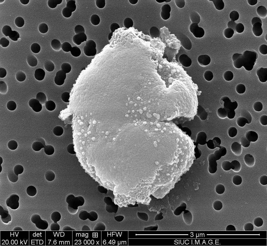 An M. aeruginosa cell 