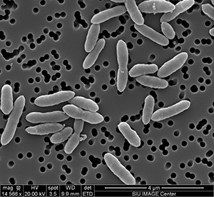 A microscopic view of novel microbiome SIUC-1.